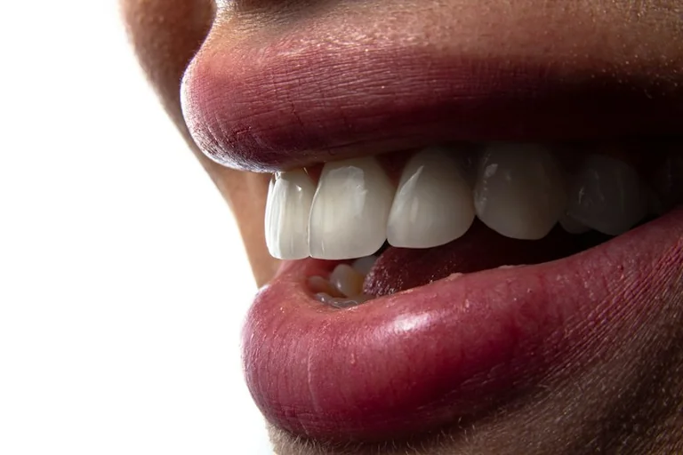 Dreams About Losing Teeth: Anxiety, Change and Practical Checks